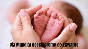 DÍA INTERNACIONAL DEL SÍNDROME DE EDWARDS: CONCIENCIACIÓN Y SOLIDARIDAD